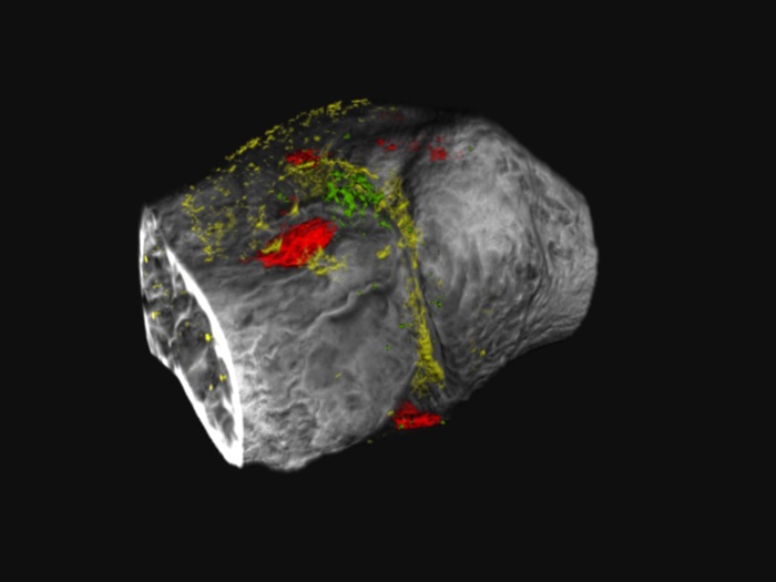 Imagen: Los nuevos agentes de contraste se dirigen a dos proteínas implicadas en la osteoartritis y se pueden visualizar mediante un escáner de TC con conteo de fotones (foto cortesía de Pan Lab)